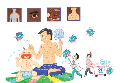 성인의 질병으로 떠오른 홍역