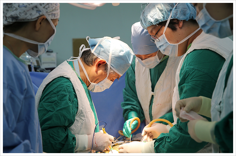 서울아산병원 장기이식센터 신장이식팀 한덕종 교수(왼쪽에서 두번째)가 신장이식 수술을 시행하고 있는 모습이다.