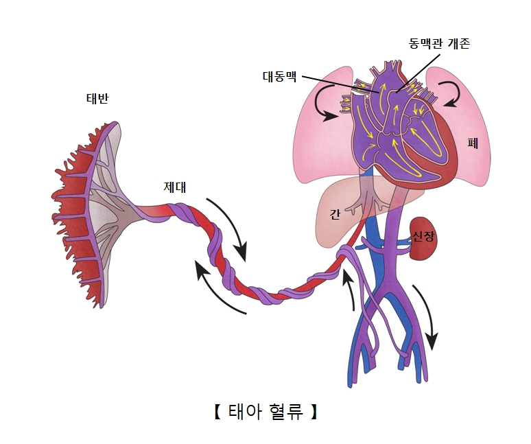 동맥관 개존 대동맥 폐 간 신장 제대 태반의 위치및 태아의 혈류 예시