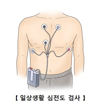 일상생활 심전도 검사 예시