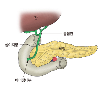 간 십이지장 총담관 췌장 바터팽대부의 구조 예시