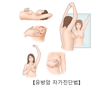 유방암 자가진단법 예시