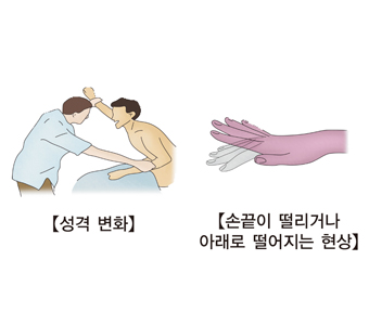 성격변화 손끝이 떨리거나 아래로 떨어지는 현상등 급성 간부전의 특성 예시