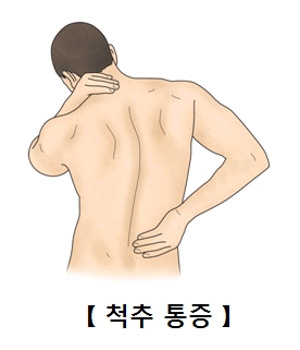 왼손으로는 목을 오른손으론 허리를 만지고있는 남성