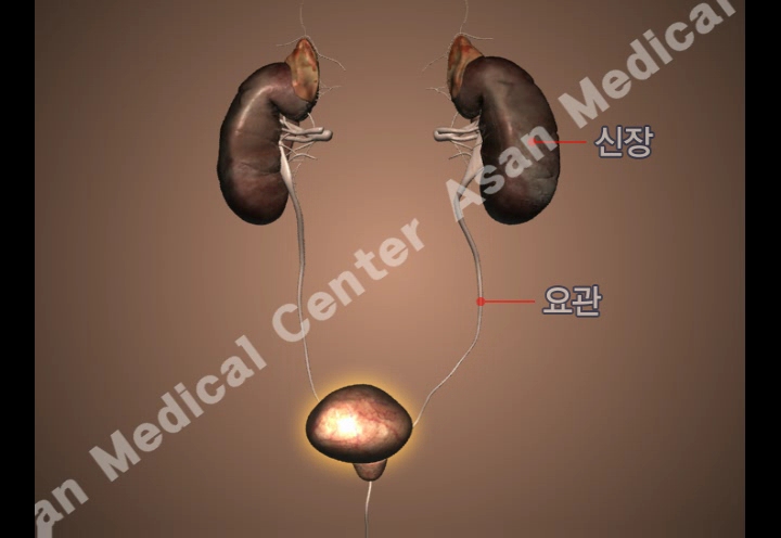 신장 및 요관의 예시