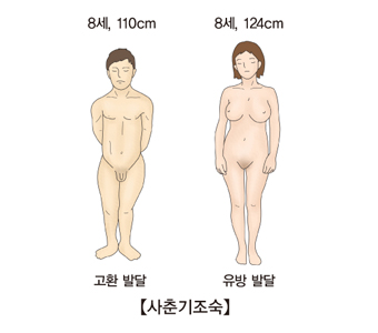 남성의 경우 8세 110cm 고환발달 및 여성의 경우 8세 124cm 유방발달등 사춘기 조숙의 대한 예시