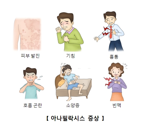 피부발진 기침 흉통 호흡곤란 소양증 빈맥등 아나필락시스 증상의 예시