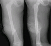 고관절이 골절된 X-ray사진