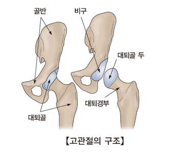 고관절의구조및 골반,대퇴골,대퇴경부,대퇴골 두,비구의 위치