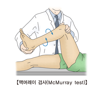 의사가 환자에게 맥머레이 검사를 하고있음
