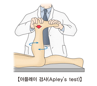 의사가 환자에게 아플레이 검사를 하고있음