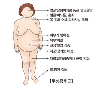  얼굴 달덩이처럼 둥근 얼굴모양 여드름 홍조 목 뒤와 어깨 피하지방 조직 피부가 얇아짐 복부 비만 신장 혈압상승 자궁 성기능 이상 다리 골다공증이나 근력 약화 발 멍이 잘듦등 여성 쿠싱증후군의 예시