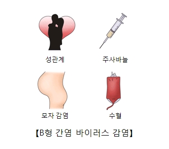 성관계 주사바늘 모자감염 수혈등 B형 간염 바이러스 감염의 예시