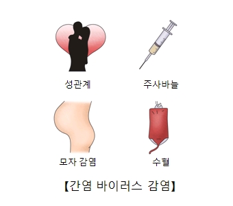 간염바이러스감염의원인 성관계 주사바늘 모자감염 수혈