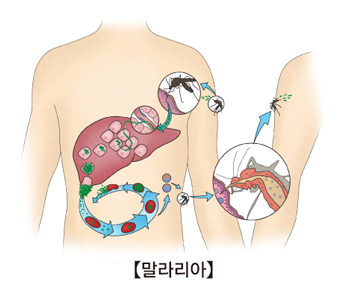 말라리아원충이 모기가되어 이사람에서 저사람으로 옮기는과정 예시