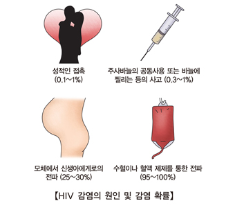 HIV감염의원인및감염확률 성적인접촉(0.1%~1%) 주사바늘의공동사용또는바늘에찔리는등의사고(0.3%~1%) 모체에서신생아에게로의전파(25%~30%) 수혈이나혈액제제를통한전파(95%~100%)