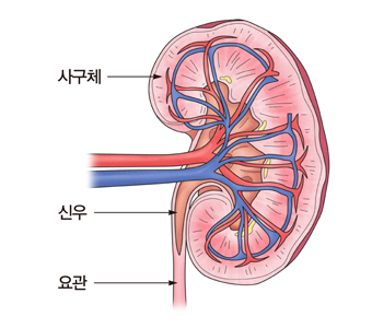 신우신염 요관염 요도염 방광염등 요로감염의 부위 예시