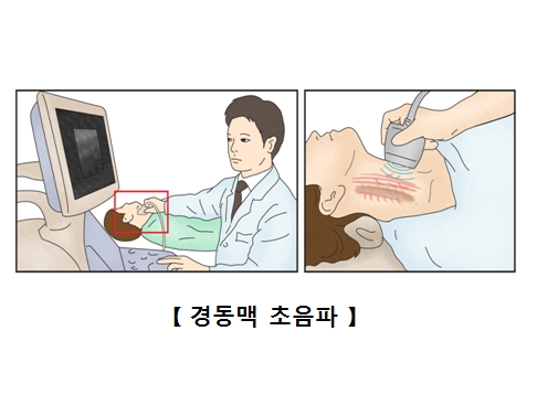 경동맥 초음파를 받구 있는 남성