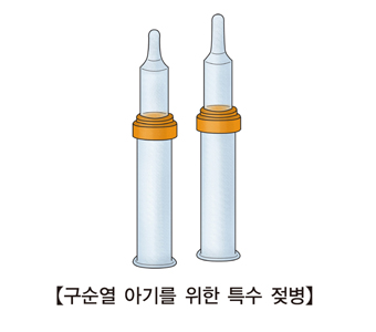 구순열 아기를 위한 특수 젖병의 예시