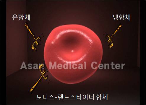 온항체 냉항체 도나스 랜드스타이너 항체의 예시