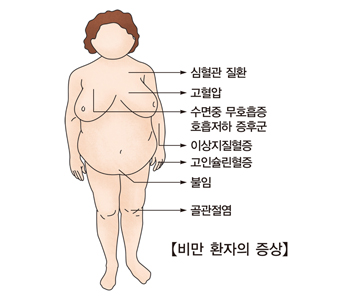 비만환자의증상 심혈관질환,고혈압,수면중무호흡증,호흡저하증후군,이상지질혈증,고인슐린혈증,불임,골관절염