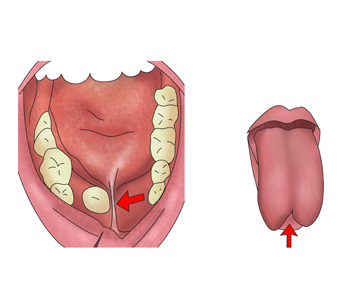 입안의 설소대와 혀의 모습
