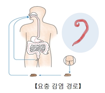 위생관리를 하지않아 소대변을 통해 요층증에 감염될수있는 구조 예시및 요충의모습예시