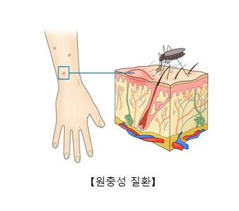 손목의한부분을 체체파리가 피를빨아먹고있음