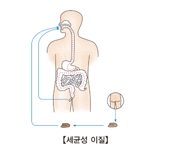 위생관리를 하지않아 소대변을 통해 세균성이질이 걸릴수있는 구조 예시