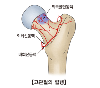 고관절의 혈행과 외측골단동맥 외회선동맥 내회선동맥의 위치