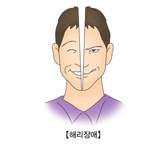 해리장애- 한쪽은 웃고있지만 다른 한쪽은 비웃고있는 모습 