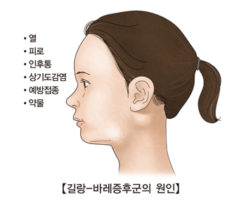 길랑-바레증후군의 원인-열,피로,인후통,상기도감염,예방접종,약물