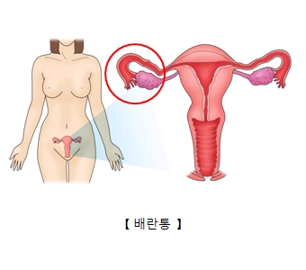 배란통-자궁과 나팔관의 위치