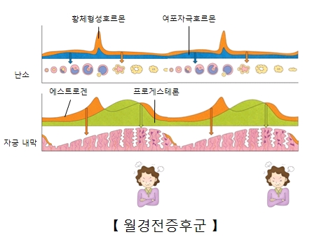 월경전증후군-난소안의 황체형성호르몬과 여포자극호르몬 분비량,자궁내막의 에스트로겐과 프로게스테론의 분비량