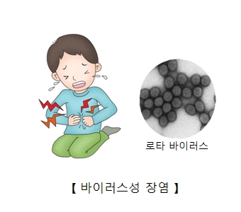 복통을 호소하는 남자아이 및 로타바이러스스 등 바이러스성 장염의 예시