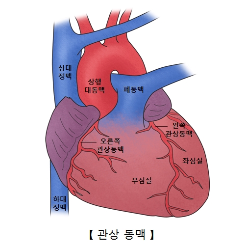 상대정맥 상행대동맥 폐동맥 오른쪽 관상동맥 왼쪽관상동맥 좌심실 우심실 하대정맥의 위치및 관상동맥의 예시