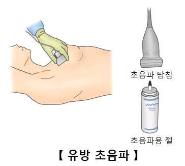 유방 초음파 검사를 하고 있는 여성