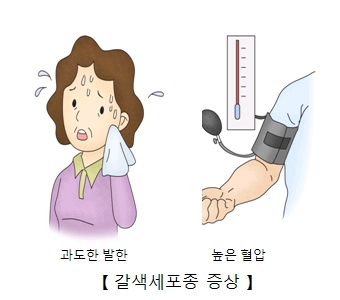 갈색세포종 증상-과도한발한,높은 혈압