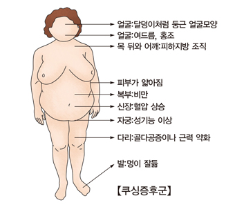 쿠싱증후군-얼굴:달덩이처럼 둥근얼굴 모양, 얼굴:여드름및홍조, 목 뒤와 어깨:히아지방 조직, 피부가앏아짐, 복부:비만, 신장:혈압상승, 자궁:성기능이상, 다리:골다공증이나 근력약화, 발:멍이잘듦