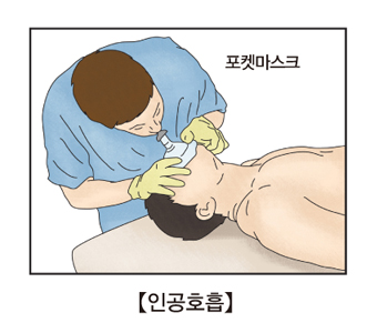 포켓마스크로 인공호흡을 하구 있는 예시