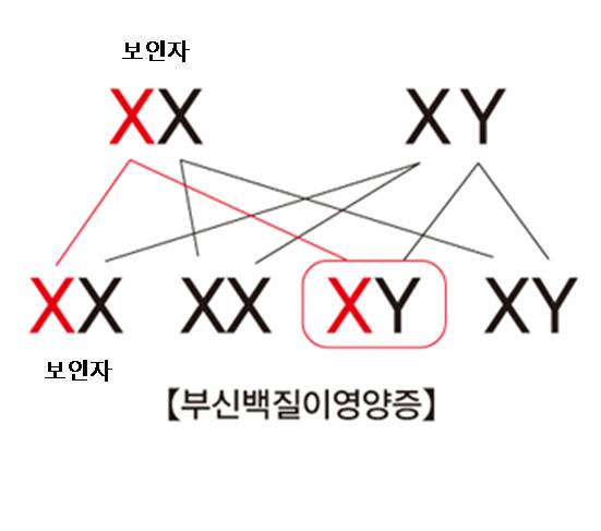 보인자에 따른 부신백질이영양증의 대한 예시