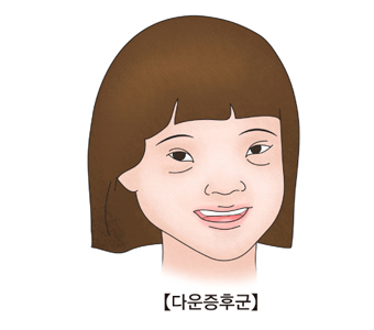 다운증후군에 걸린 여자 아이의 그림 예시