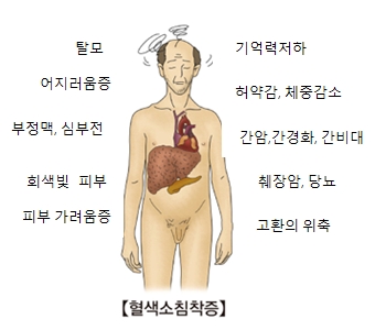 혈색소침착증-탈모,어지러움증,부정맥,심부전,회색빛피부,피부가려움증,고환의위축,췌장암,당뇨,간암,간경화,간비대,허약감,체중감소,기억력저하