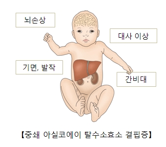 중쇄 아실코에이 탈수소효소 결핍증-뇌손상,기면,발작,간비대,대사이상