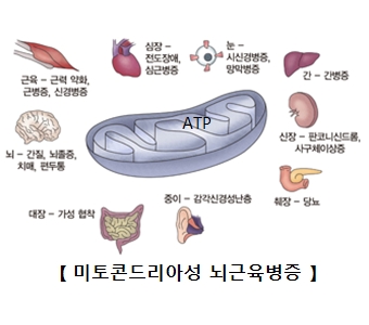 미토콘드리아성 뇌근육병증- 근육:근력약화,근병증,신경병증, 뇌:간질,뇌졸증,치매,편두통, 대장:가성협착, 중이:감각신경성난층, 췌장:당뇨, 신장:판코니신드롬,사구체이상증, 간:간병증, 눈:시신경병증,양막병증, 심장:전도장애,심근병증