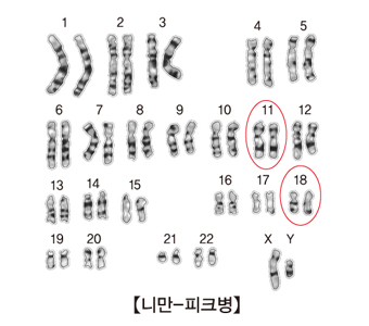니만-피크병 염색체 그림 예시