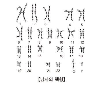 남자의 핵형 그림 예시