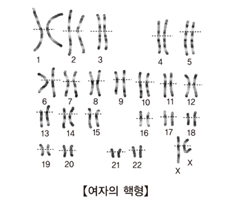 여자의 핵형 그림 예시