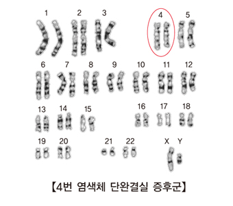 4번 염색체 단완결실 증후군 그림 예시