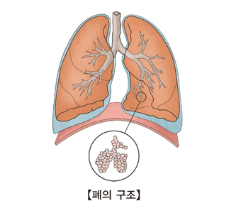 폐의 구조를 나타낸 예시